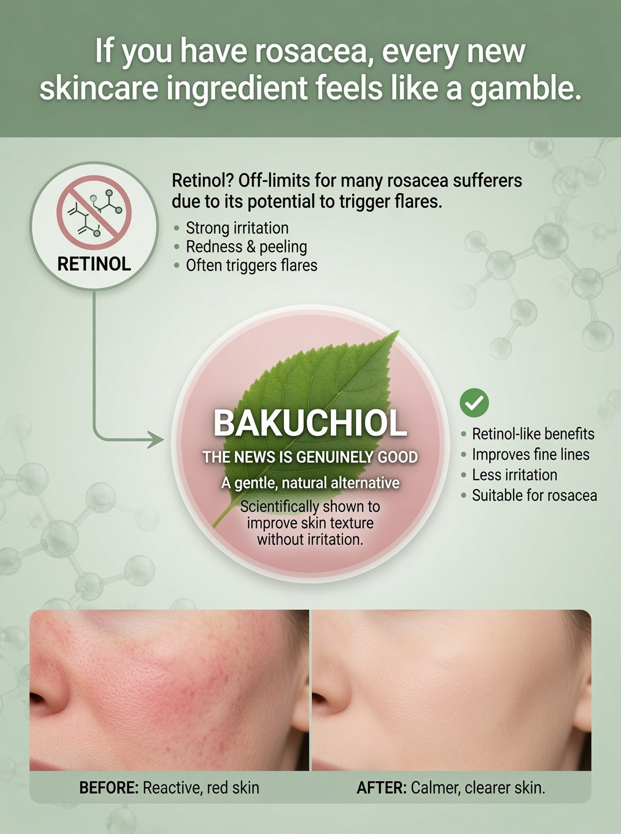 Is Bakuchiol Good for Rosacea? Science-Backed Answer 2026