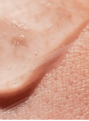 AHA Peeling Concentrate, 30ml/ 1.0 fl oz – Natural 30ml/ 1.0 fl oz by Radiant Bloom – Natural Organic Skincare